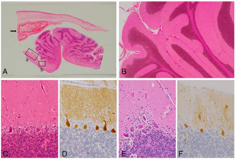 Muestras del tejido cerebral encontrado en el teratoma. Foto: Masayuki Shintaku